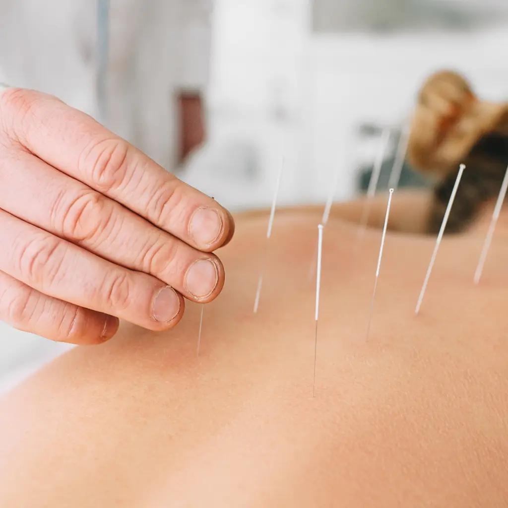 Acupuncture Kenitra